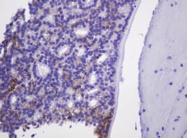 Monoclonal Mouse anti-Human CA12 / Carbonic Anhydrase XII Antibody (clone OTI2C6, IHC, WB)