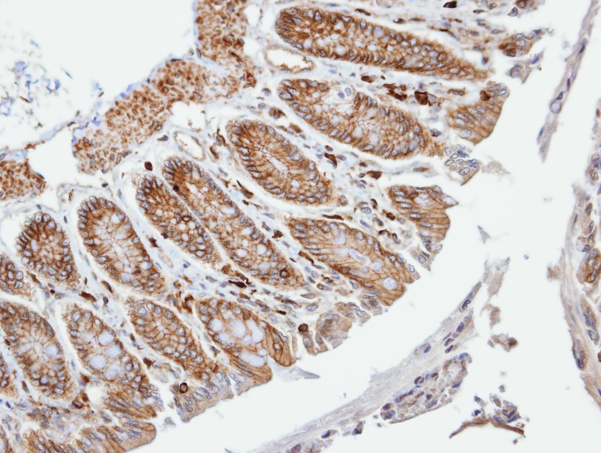 Polyclonal Rabbit anti-Human PALS2 / MPP6 Antibody (aa1-44, IHC, WB)