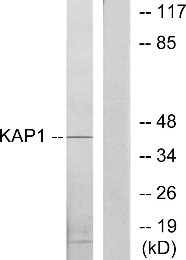 IHC-plus™ Polyclonal Rabbit anti-Human PRKAR1B Antibody (aa106-155, IHC, WB)