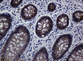 CDH1 / E Cadherin Antibody (clone OTI4F1)