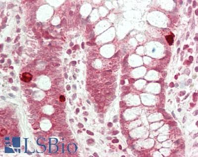 IHC-plus™ Polyclonal Rabbit anti-Human DNAJA4 Antibody (IHC, WB)
