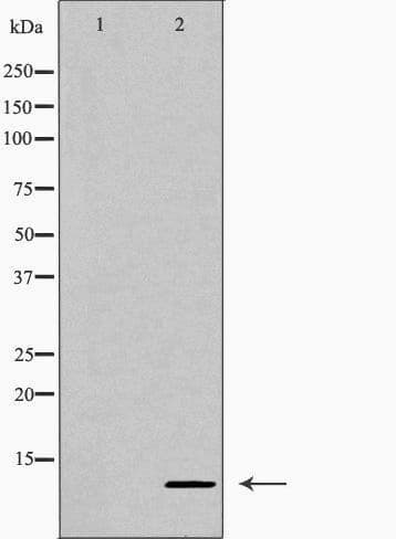 CXCL10 / IP-10 Antibody