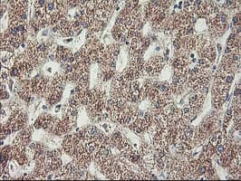 Monoclonal Mouse anti-Human MTFMT Antibody (clone OTI1E7, aa175-389, IHC, WB)