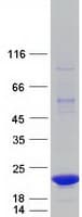 Human SPANXA1 Protein (Recombinant Myc-DDK (Flag))