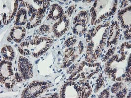 Monoclonal Mouse anti-Human ALOX15 / 15-Lipoxygenase Antibody (clone OTI3G8, IHC, IF, WB)