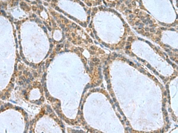 Polyclonal Rabbit anti-Human CNTN4 Antibody (IHC)
