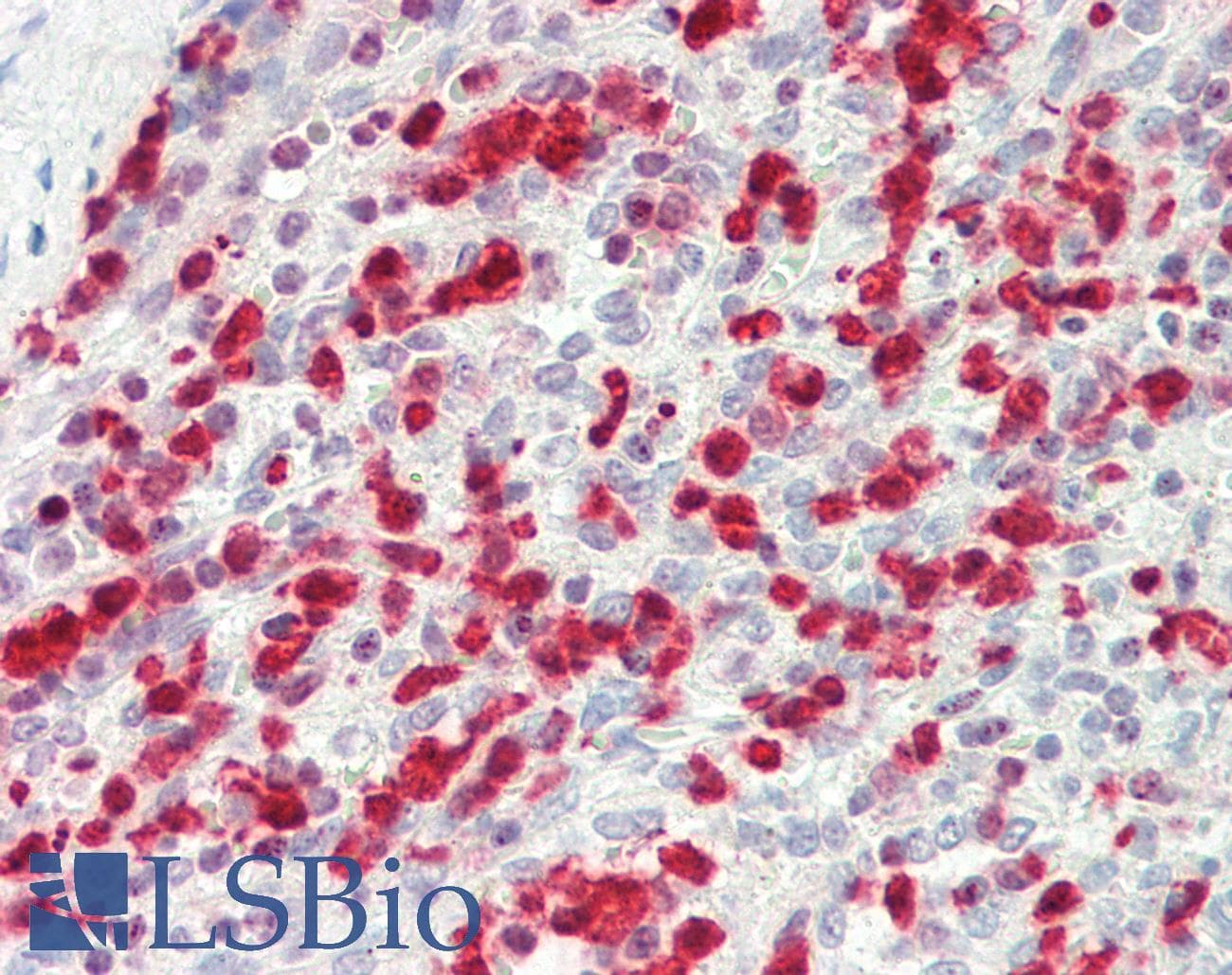 IHC-plus™ Polyclonal Rabbit anti-Human ITGB5 / Integrin Beta 5 Antibody (aa216-244, IHC, WB)