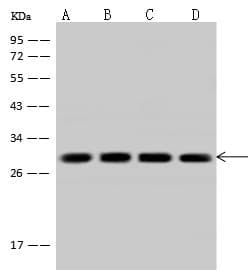 Polyclonal Rabbit anti-Human CACYBP Antibody (IHC, IF, WB)
