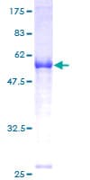 Human FANCA Protein (Recombinant GST)