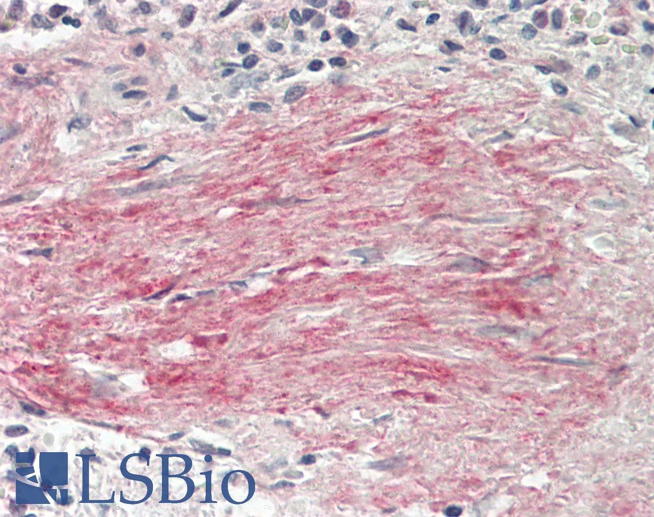 BGN / Biglycan Antibody (aa230-366)