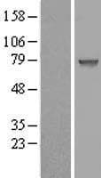 CCDC27 Protein (Over-Expression Lysate Myc-DDK (Flag))