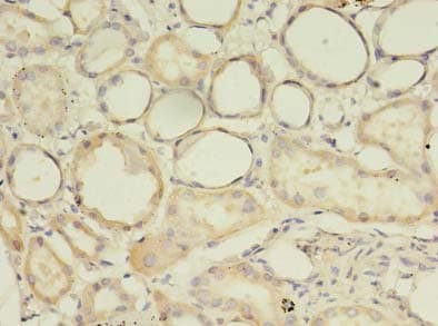 Polyclonal Rabbit anti-Human ARHGAP25 Antibody (IHC)