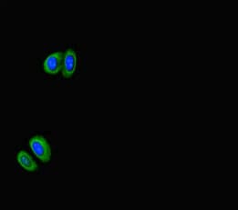 Polyclonal Rabbit anti-Human RPS6KB1 / P70S6K / S6K Antibody (IF)