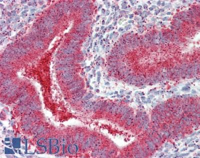 IHC-plus™ PTAR2 / FNTA Antibody (aa329-379)