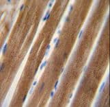 Polyclonal Rabbit anti-Human TNIP1 Antibody (aa454-482, IHC, WB)