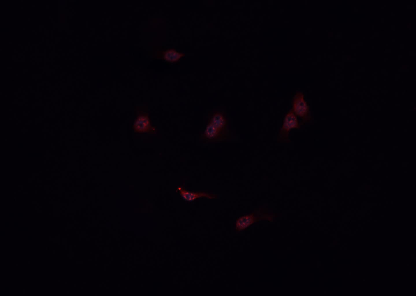 Polyclonal Rabbit anti-Human KNG1 / Kininogen / Bradykinin Antibody (IHC, IF, WB)