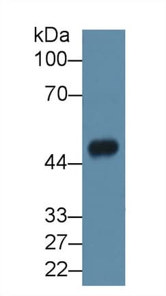 ASAH1 / Acid Ceramidase Antibody (aa143-395)