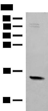 RPS12 / Ribosomal Protein S12 Antibody