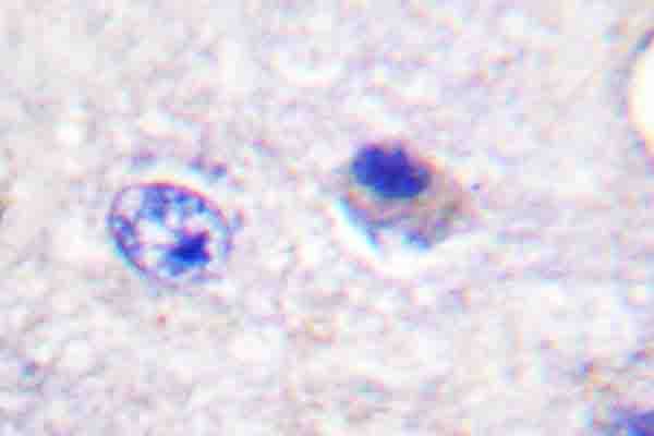 Polyclonal Rabbit anti-Human Acetyl-CoA Carboxylase / ACC Antibody (phospho-Ser80, IHC, WB)
