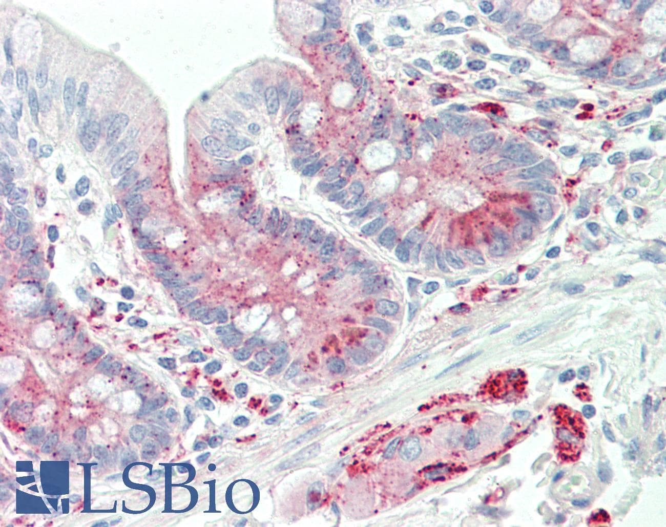 IHC-plus™ ADORA1 / Adenosine A1 Receptor Antibody (Asp326)