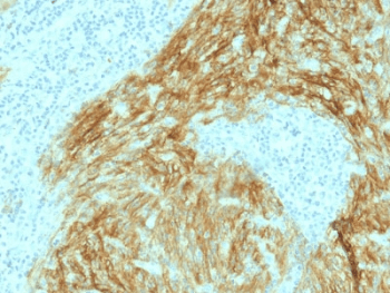 CR2 / CD21 Antibody (clone CR2/1952)
