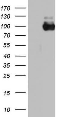 ACE2 / ACE-2 Antibody (aa18-237, clone OTI1D6)