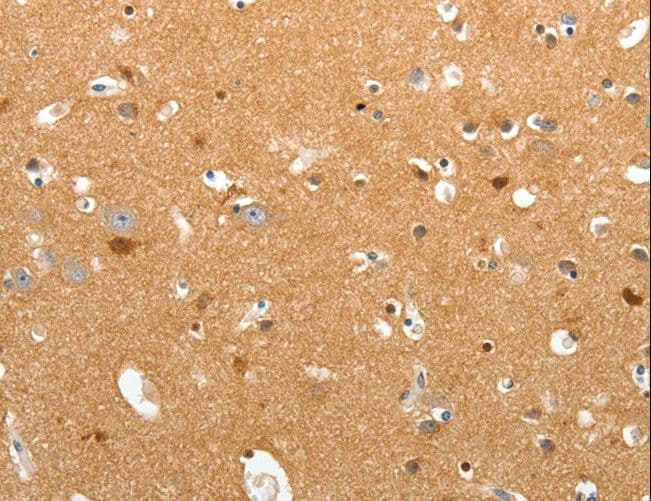 Polyclonal Rabbit anti-Human TNR / Tenascin R Antibody (IHC)