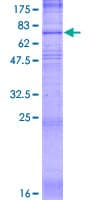 Human SLC19A1 Protein (Recombinant GST)