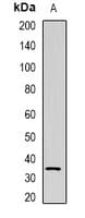 NAT1 / AAC1 Antibody