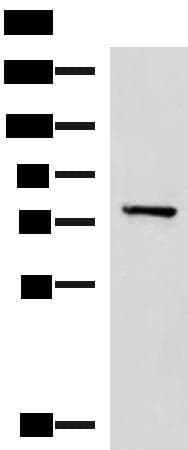 Polyclonal Rabbit anti-Human CAPN5 / Calpain 5 Antibody (WB)