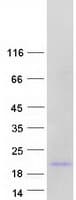 Human FKBP2 Protein (Recombinant Myc-DDK (Flag))