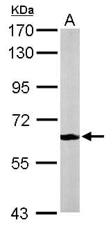 MPP2 Antibody (aa86-486)