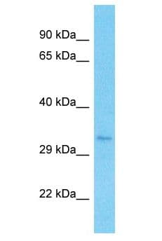 Polyclonal Rabbit anti-Human RAD51 / RECA Antibody (aa15-64, WB)
