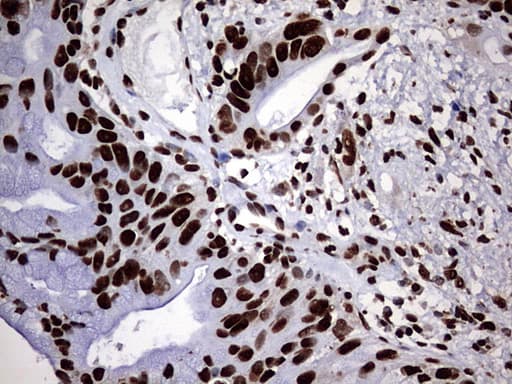 HNRPM / HNRNPM Antibody (aa1-261, clone OTI1E12)