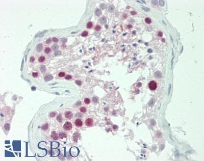 IHC-plus™ TPX2 Antibody (aa281-330)