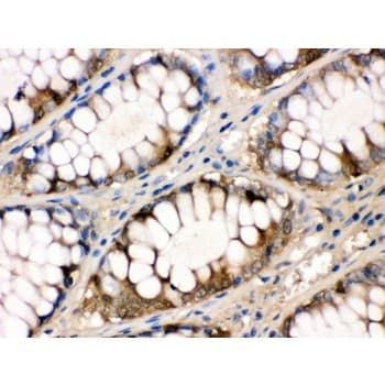 FABP1 / L-FABP Antibody (aa6-36)
