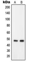 Polyclonal Rabbit anti-Human GPRIN2 / GRIN2 Antibody (N-Terminus, IHC, WB)