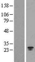 SPC25 Protein (Over-Expression Lysate Myc-DDK (Flag))