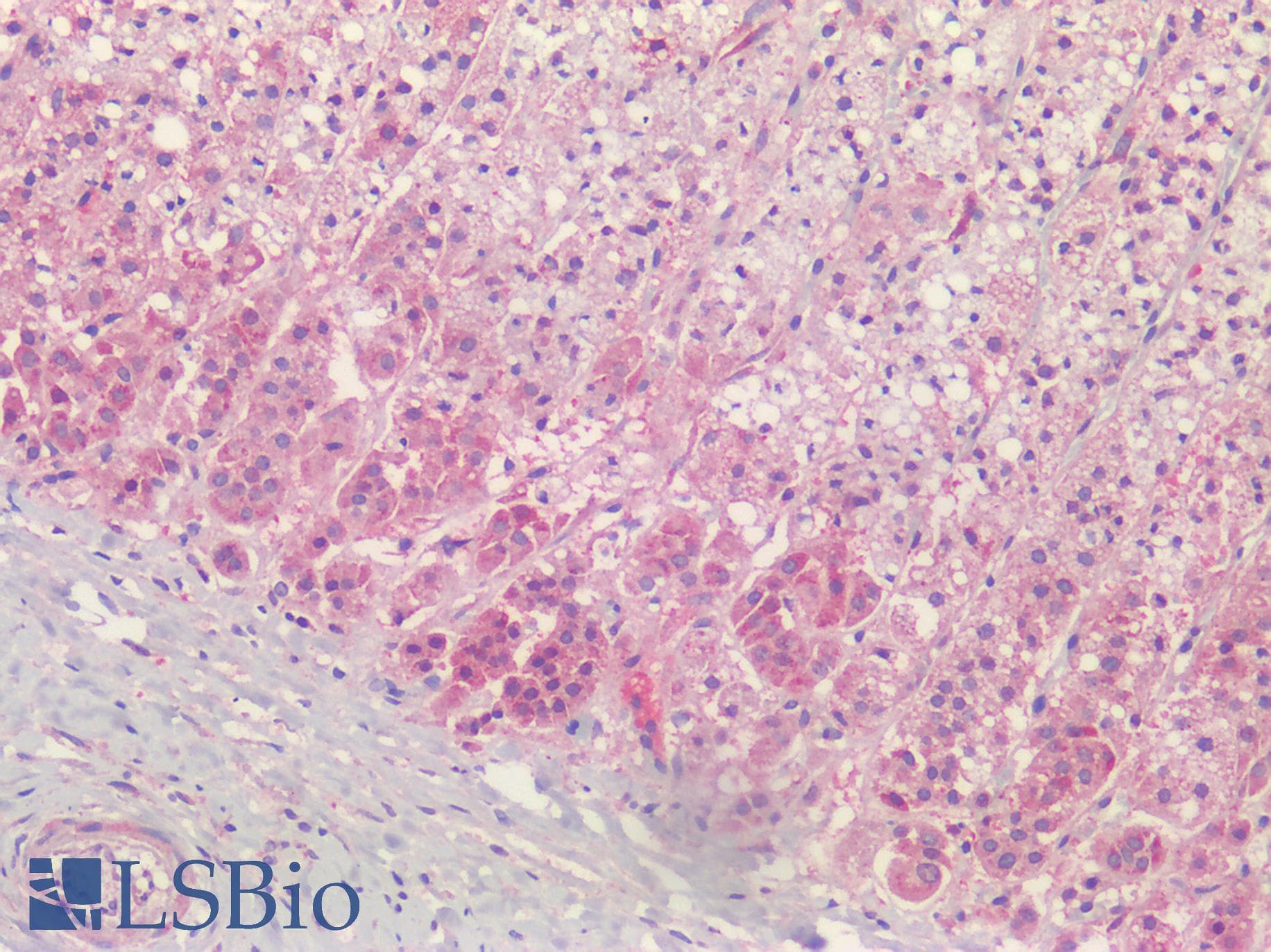 IHC-plus™ Polyclonal Rabbit anti-Human PGAP1 Antibody (N-Terminus, IHC, IF, WB)