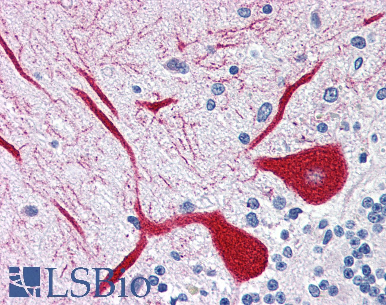 IHC-plus™ ITPR1 / IP3 Receptor Type 1 Antibody (aa1892-1911)