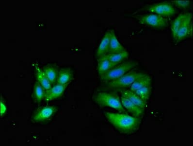 PODXL / Podocalyxin Antibody