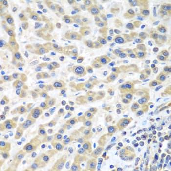 Polyclonal Rabbit anti-Human IL2 Antibody (IHC, WB)