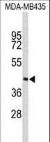 RD / PHYH Antibody (aa59-87)