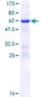 Human NOSIP Protein (Recombinant GST)