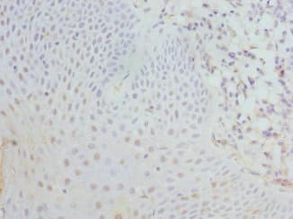 EIF2S3 / EIF2G Antibody