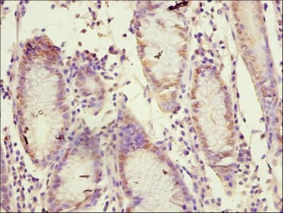 MMP10 Antibody