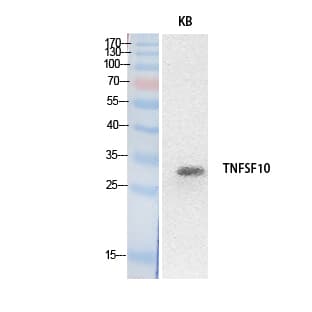 TNFSF10 / TRAIL Antibody