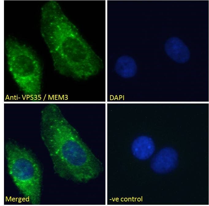 PathPlus™ VPS35 Antibody (aa783-796)