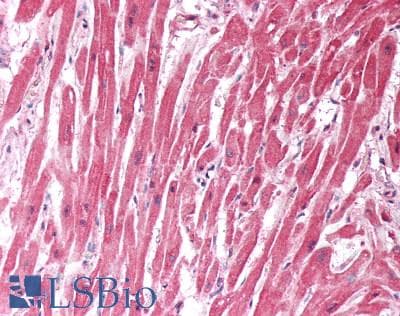 IHC-plus™ Polyclonal Goat anti-Human CHCHD3 Antibody (aa173-185, IHC, WB)