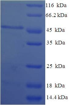 Human HSD17B11 Protein (Recombinant His-SUMO)